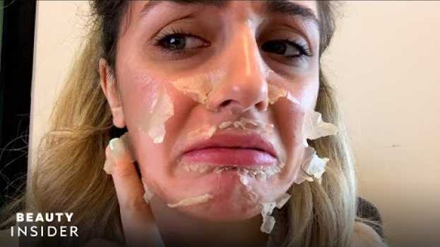 Video What It’s Like To Get A Chemical Peel For Acne Scars | Beauty Explorers | Beauty Insider na Polish