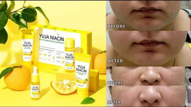 Video SOME BY MI Yuja Niacin 30 Days Brightening Starter Kit Review 🍋  | Korean Skincare | K-BEAUTY su italiano