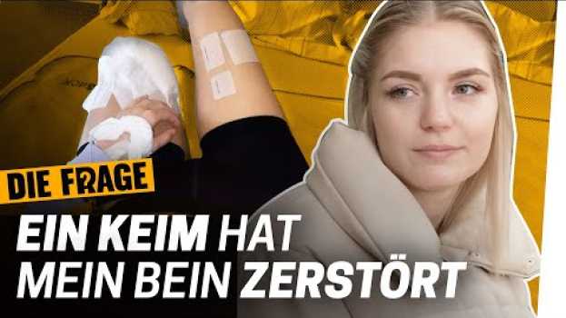 Video Amputation: 33 Operationen konnten mein Bein nicht retten | Wie komme ich mit meinem Körper klar? #6 in Deutsch