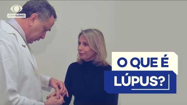 Video Você sabe o que é lúpus? Entenda causas, sintomas e tratamentos na Polish