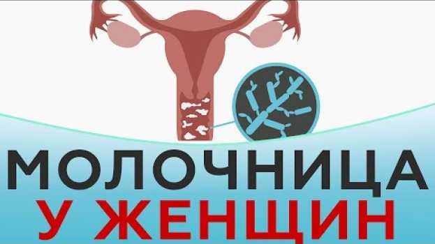 Video Молочница у женщин in English