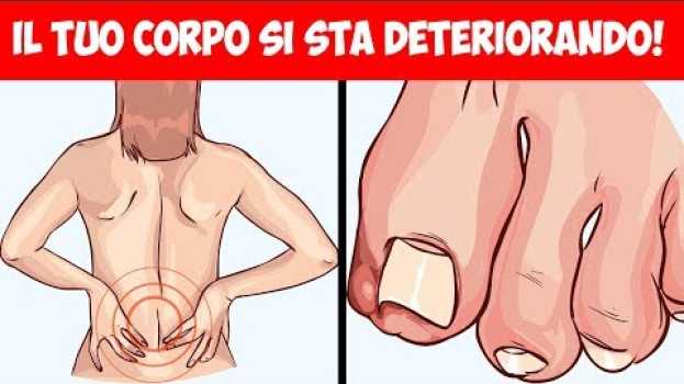 Video Alcuni segni comuni che dicono che il tuo corpo si sta lentamente deteriorando su italiano
