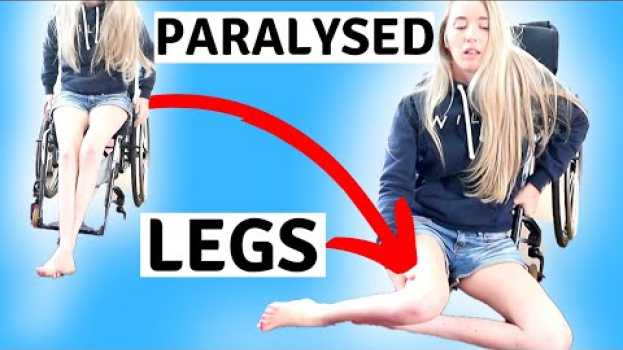 Видео ♿️MY PARALYSED LEGS | #limbdifferenceawarenessmonth на русском