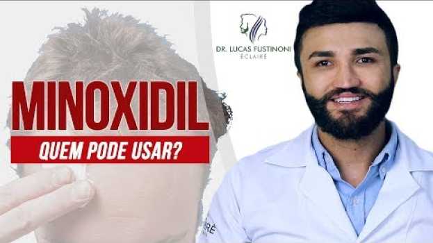 Video 🤔 MINOXIDIL: Quem pode usar? Posso usar? | Dr Lucas Fustinoni in English