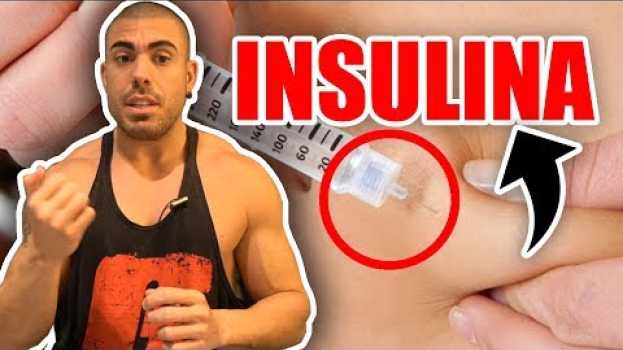 Video Tudo sobre insulina 🤓 in English