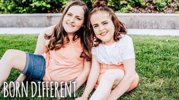 Video The Twins That Were Cut In Half | BORN DIFFERENT en français