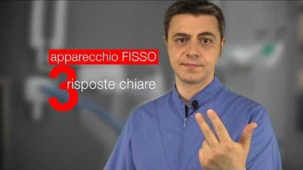 Video 3 risposte chiare sull' apparecchio fisso (senza girarci intorno) em Portuguese