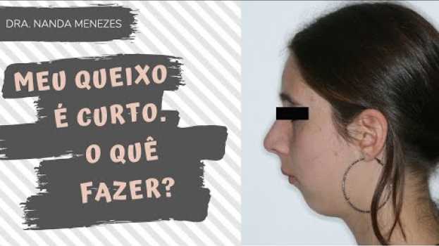 Video Seu queixo é curto? Pode ser Classe 2 | Dra Nanda Menezes en Español