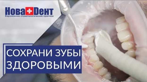 Video 👄 В чем эффективность профессиональной гигиены полости рта. Профессиональная гигиена полости рта.12+ su italiano