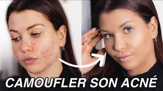 Video Comment je CAMOUFLE mon acné ! em Portuguese
