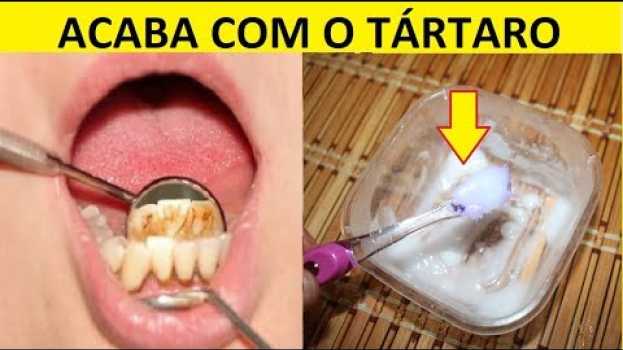 Video Escove os Dentes com Essa Mistura para Acabar com o Tártaro! Fácil e Barato! en Español