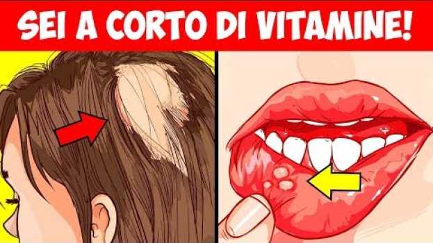 Video Gli 8 segnali di avvertimento che il tuo corpo è carente di vitamine essenziali en Español