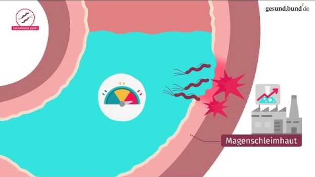 Video Wie entsteht eine Magenschleimhautentzündung? su italiano