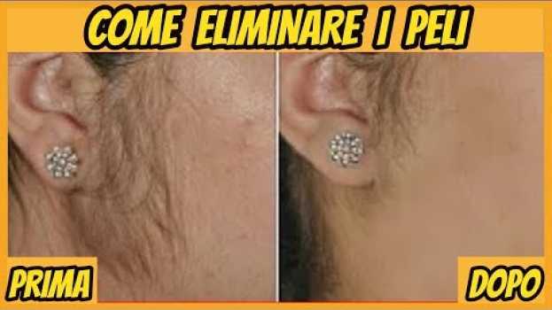 Video ♡ Come ELIMINARE i PELI sul viso - Rimedio naturale ♡ su italiano