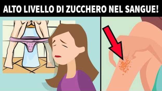 Video I 12 Segnali Che Dimostrano Che I Livelli Di Zucchero Nel Tuo Sangue Sono Molto Alti su italiano